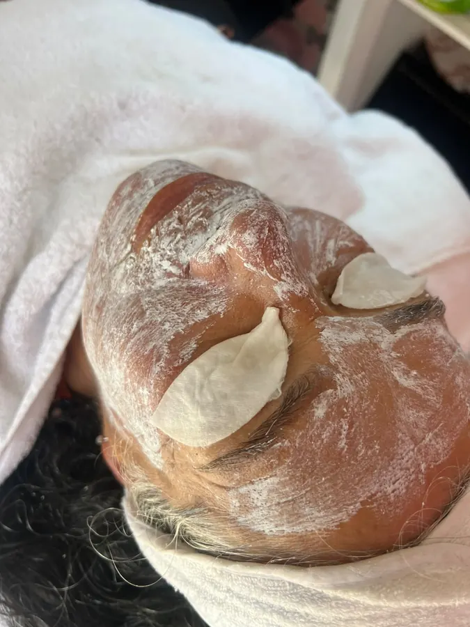Limpieza facial: durante el tratamiento, con mascarilla sobre el rostro
