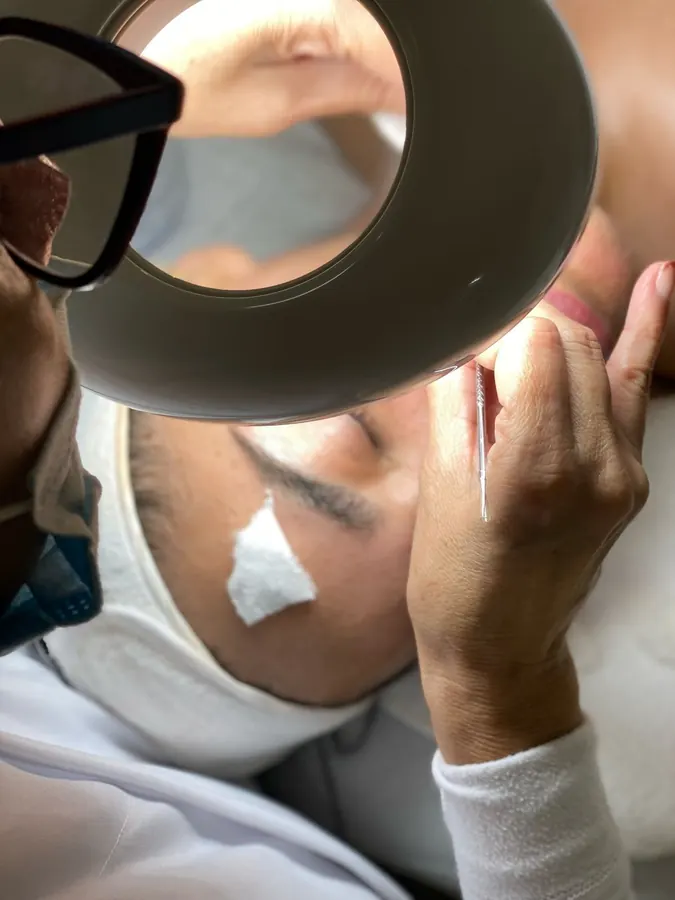 Limpieza facial: durante el tratamiento, con lámpara de aumento